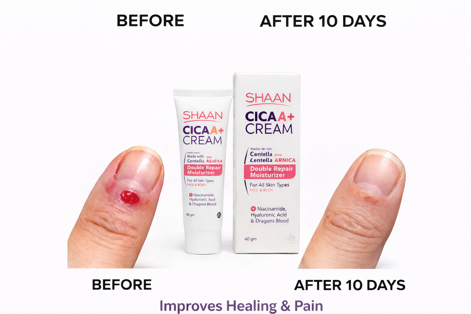 Shaan CICA ARNICA+ cream 40gm