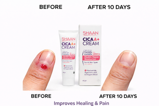 Before and after comparison of a cut on a finger with Shaan CICA+ Cream.
