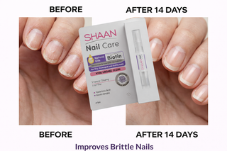 Before and after comparison of nail care product with improved nail condition, featuring Shaan.