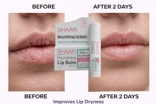 Before and after comparison of a lip balm on lips with product packaging displayed.