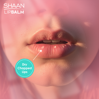 Shaan Lip balm advertisement showing dry chapped lips 