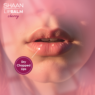 Lip balm advertisement showing dry chapped lips with 'Shaan LipBalm cherry' text.