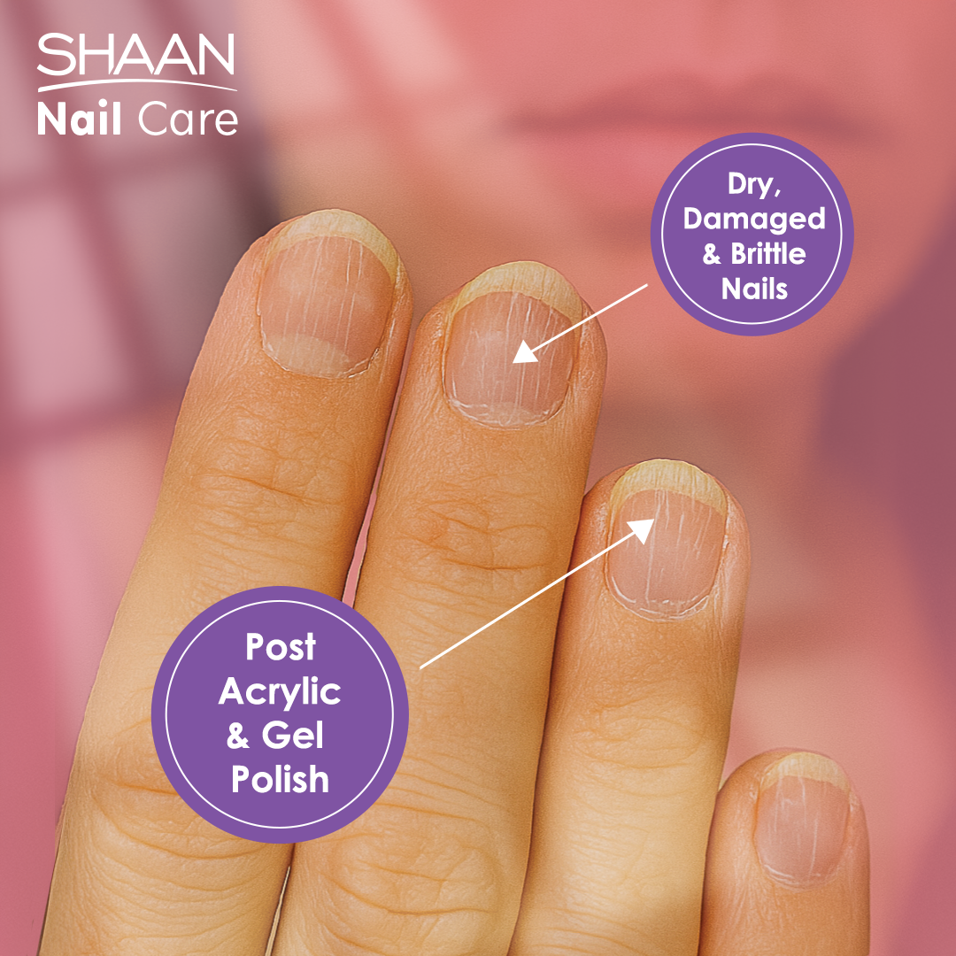 Shaan Nail Care 4 ml